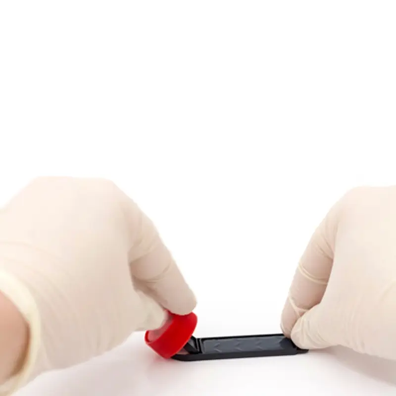 Hygicult TPC dipslides determination Total bacterial count