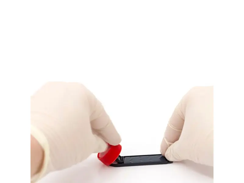 Hygicult TPC dipslides determination Total bacterial count
